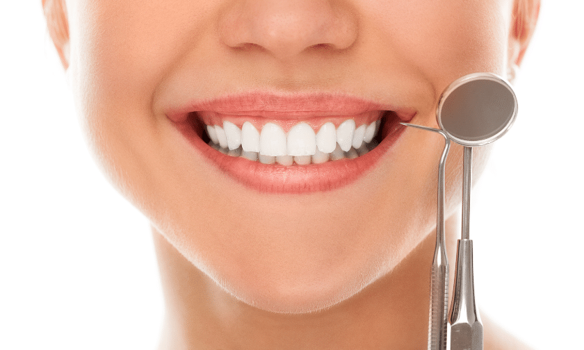 Teeth Whitening Gate City